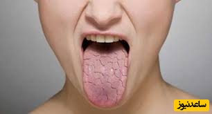 چگونه میتوان مزه ی بد دهان را درمان کرد؟