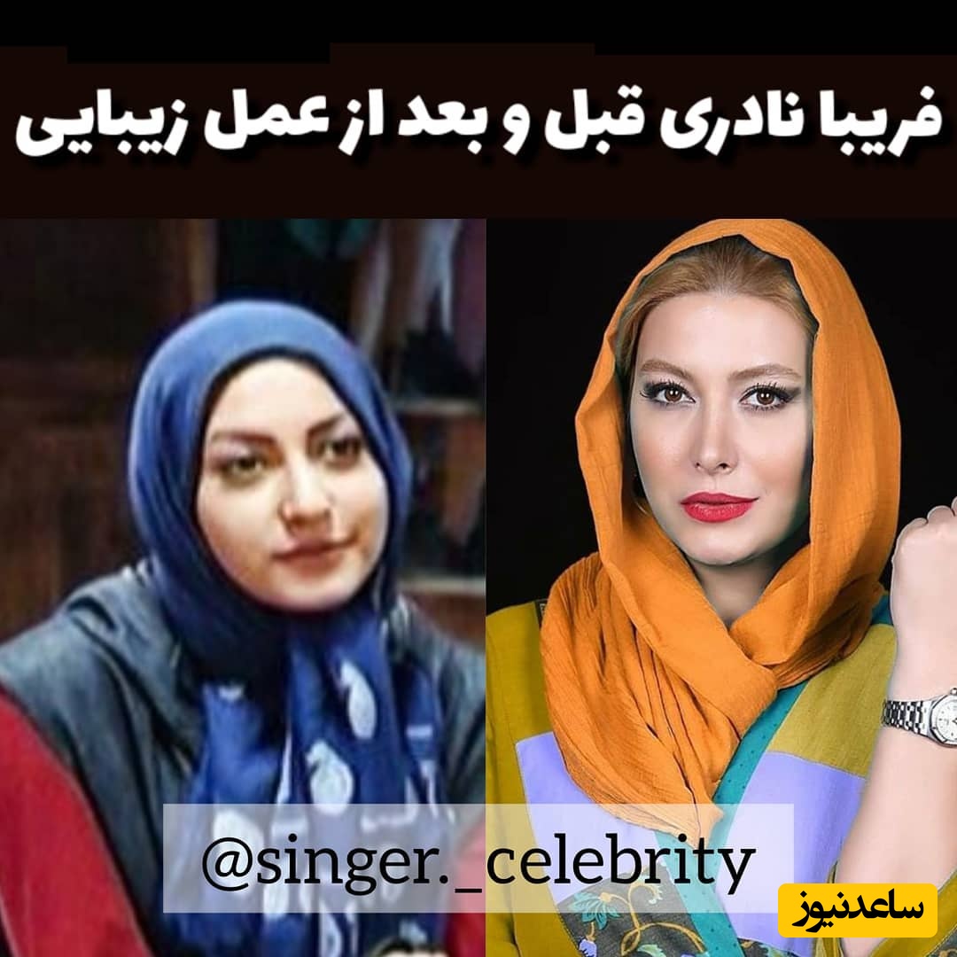 فریبا نادری بازیگر پولدار سینما: بعد از اینکه این فیلم از من پخش شد تصمیم گرفتن بینی‌ام رو عمل کنم و...+ویدیو