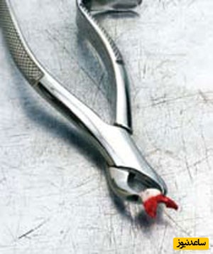   تأثیر کشیدن دندان بر زیبایی و روح و روان انسان ها