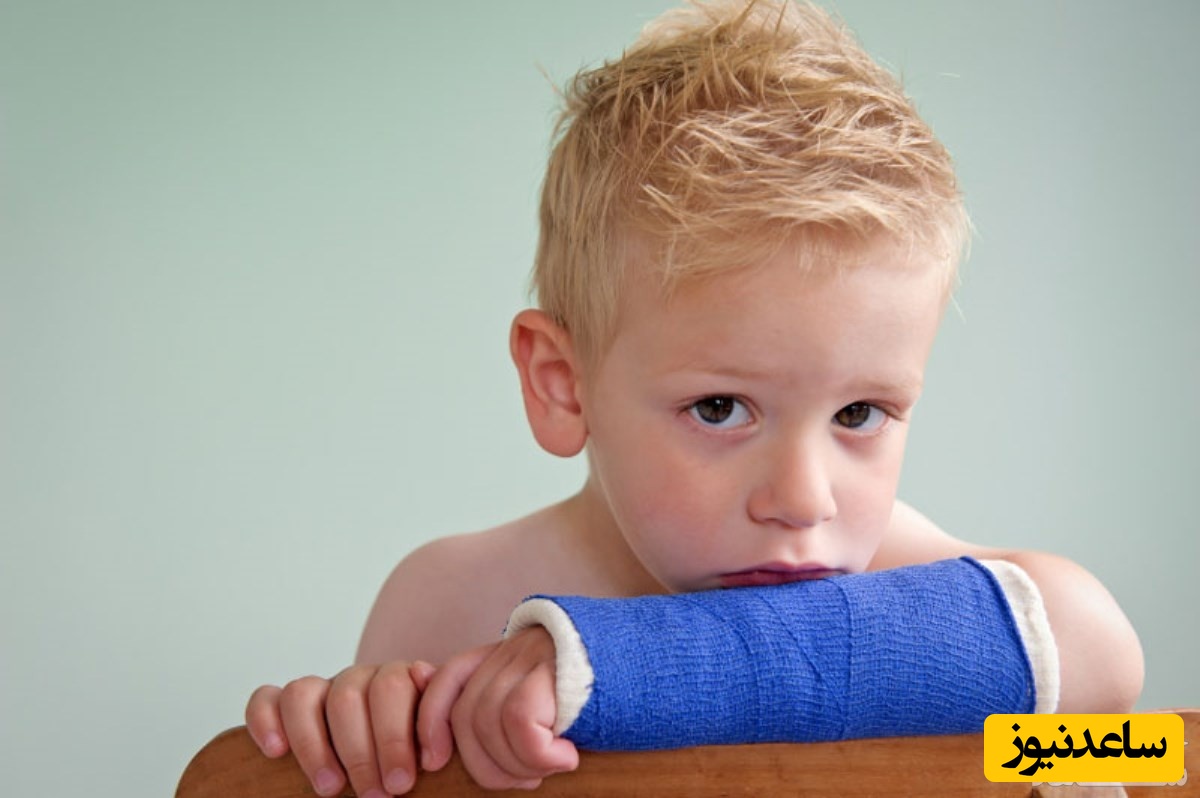نحوه مراقبت از دست و پای گچ گرفته کودک