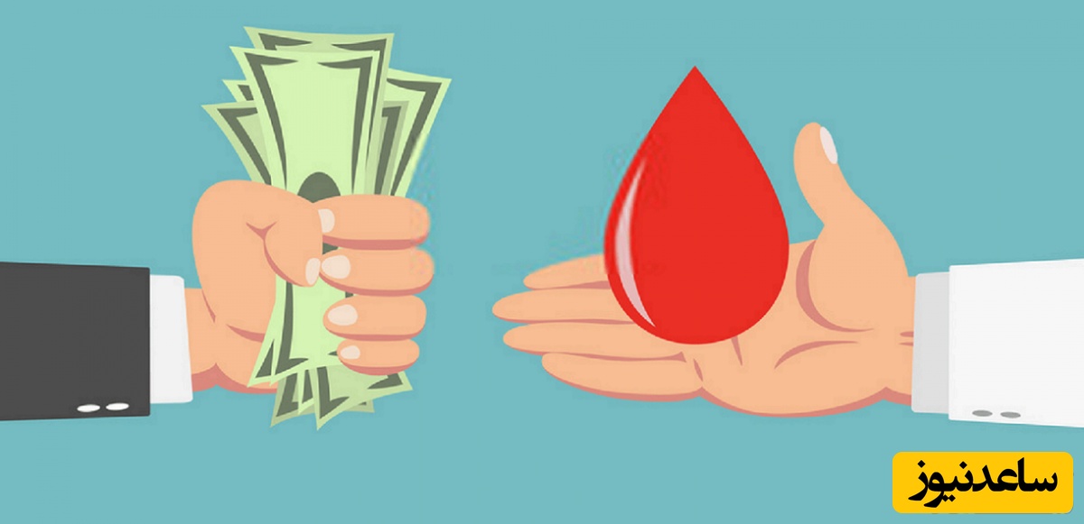 همه چیز در مورد دیه پستان و نکات حقوقی آن