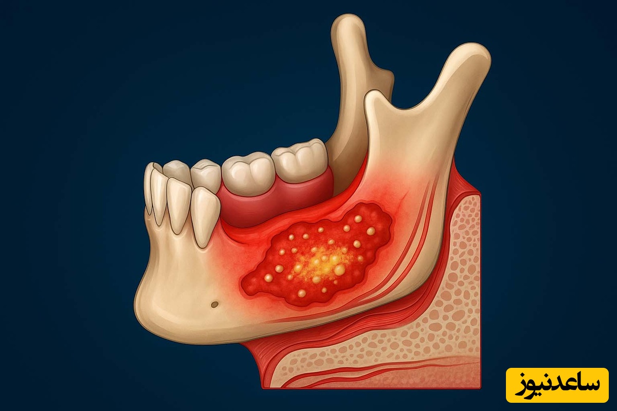 چند راه درمانی فک آنرمال بر اساس شرایط بیمار