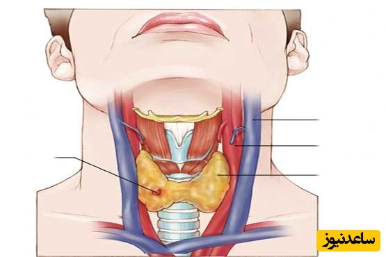 روش‌هایی ساده برای از بین بردن خلط گلو چیست؟