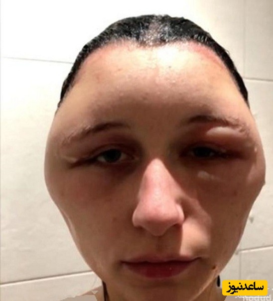 بلای  رنگ مو تقلبی
