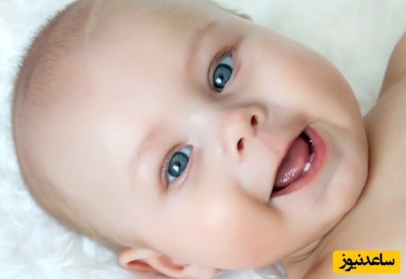 سوالات متداول در مورد برفک دهان نوزادان