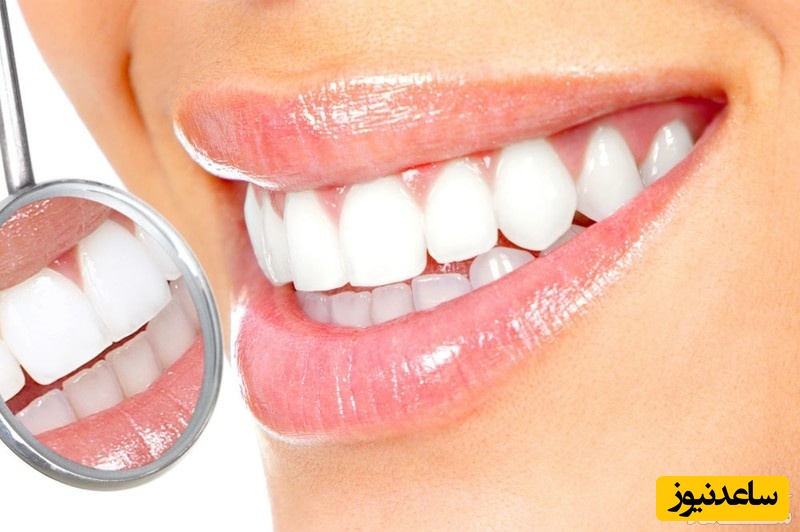استفاده از جوش شیرین برای سفید کردن دندان ها