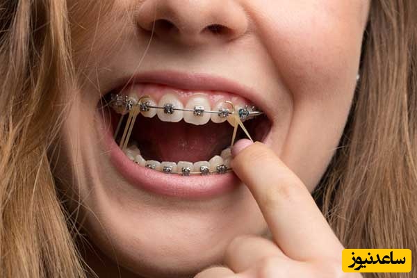 راه‌هایی ساده برای رفع مشکلات ارتودنسی دندان