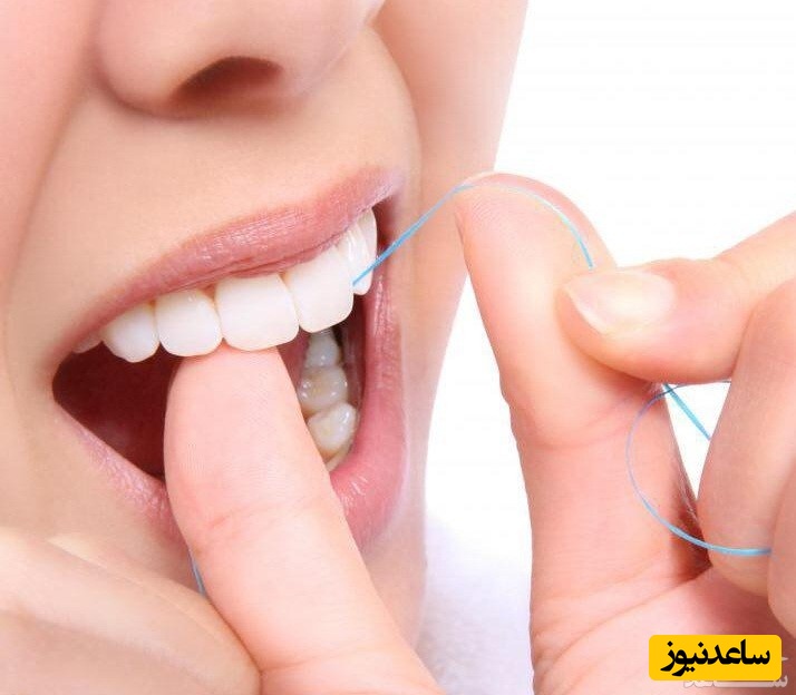عوارض و فواید نخ دندان چیست؟