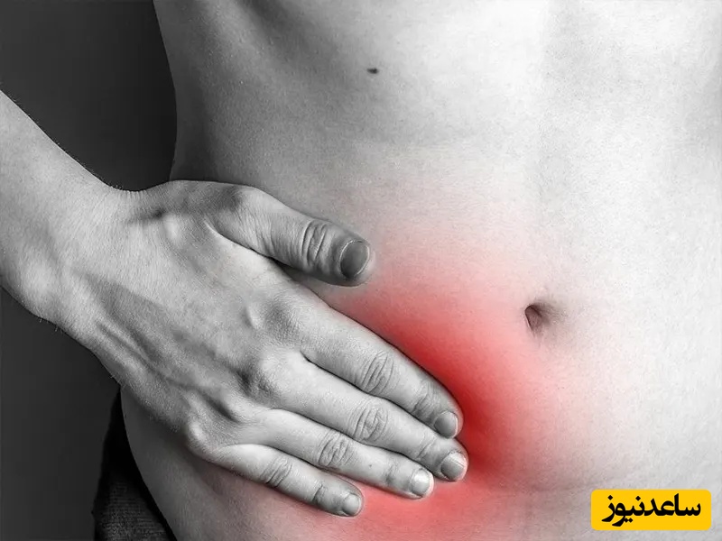 فتق؛ علائم، پیشگیری و درمان با طب سنتی و گیاهان دارویی