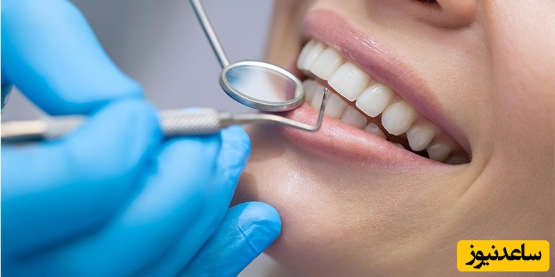 از مسواک های بین دندانی در چه مواردی می توان استفاده کرد ؟