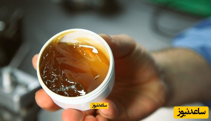 روغن فلکس چیست و چه کاربردی دارد؟