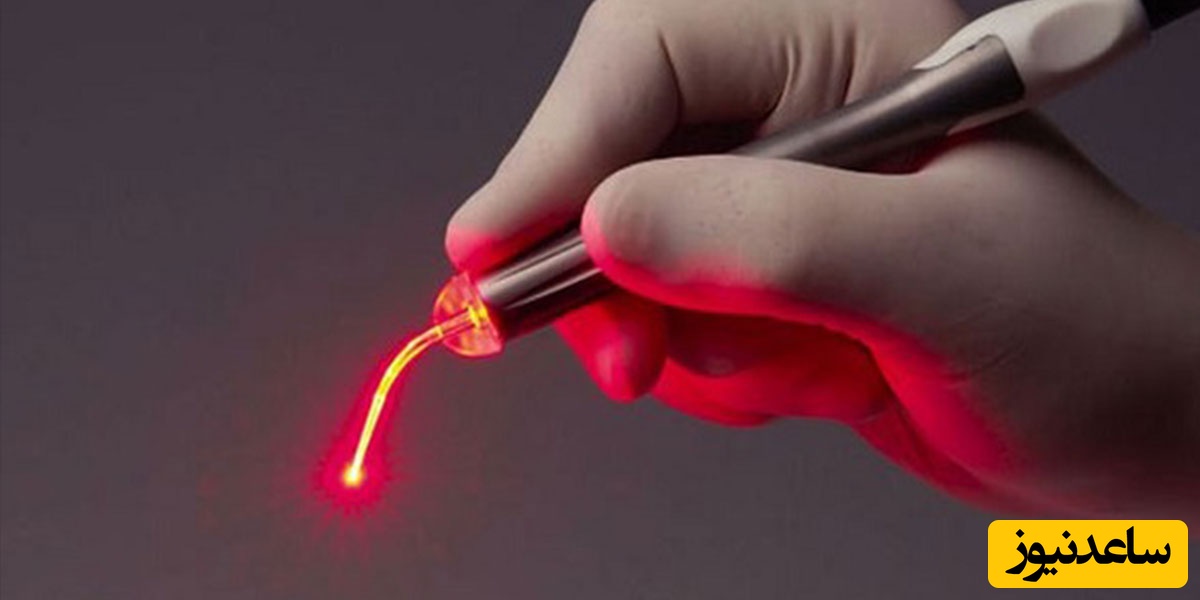 دندان پزشک چگونه با لیزر کار میکند؟