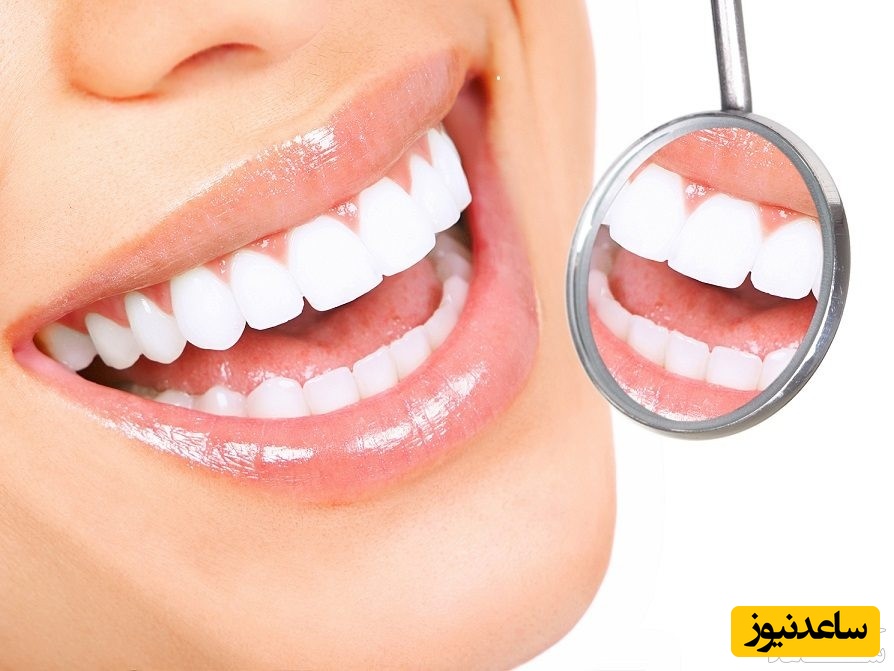 8 نکته درمورد سفیدی و زیبایی دندان