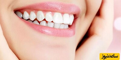 دیدن دندان در خواب چه تعبیری دارد؟ / تعبیر خواب دندان + فیلم