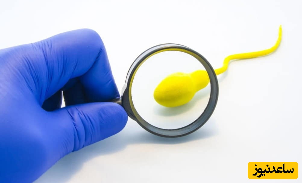 دلایل نکروزو اسپرمی و روش‌های درمان آن