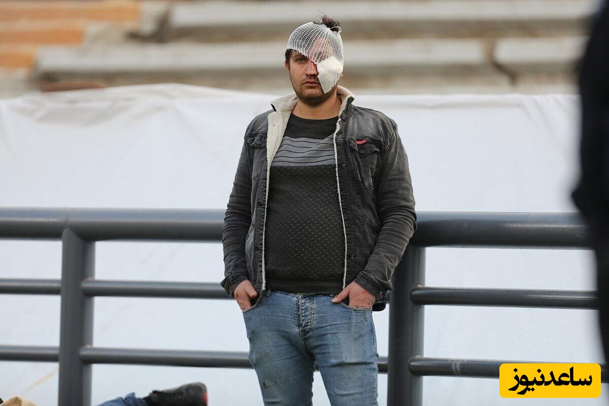 تصاویری از قربانیان پرسپولیسی و تراکتوری به خاک و خون کشیده شده آزادی/ اینجا زمین فوتبال نیست میدان جنگ است+عکس