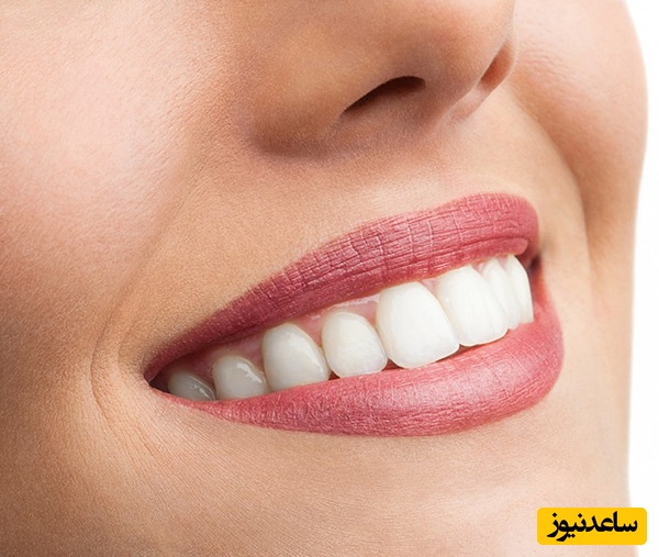 تاثیر روش‌های دندانپزشکی برای زیبایی صورت