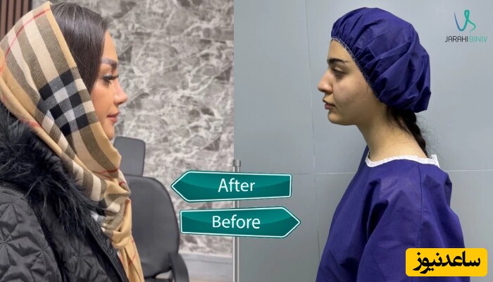 از مشاوره تا جراحی: تجربه‌ای متفاوت با بهترین جراح بینی در تهران