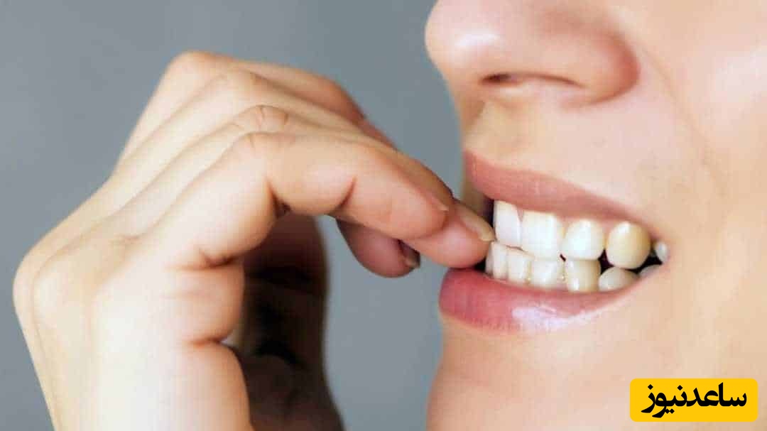 جویدن ناخن نشانه چیست؟