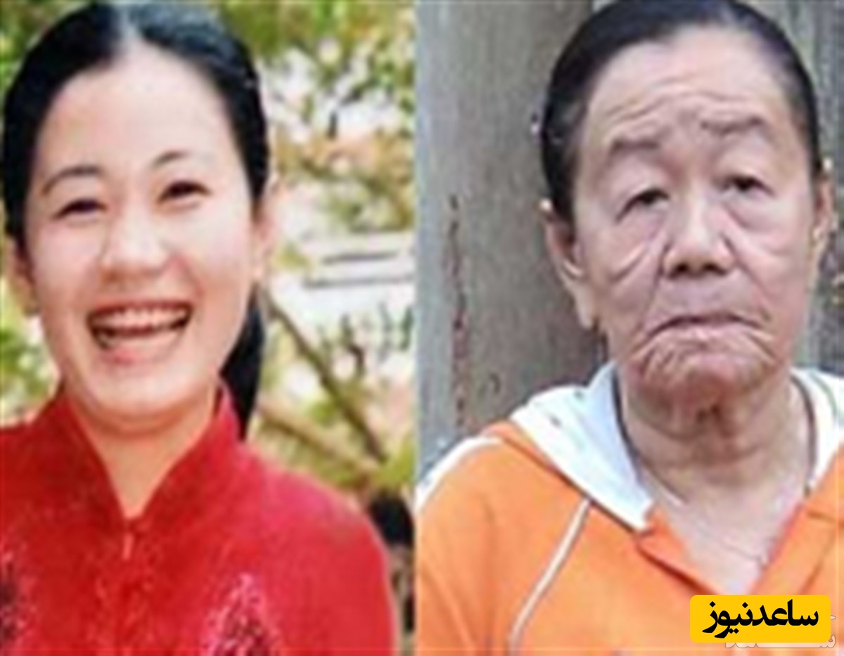 روایت وحشتناک زن 28 ساله ای که پس از زایمان ناگهان چهره اش 70 ساله شد