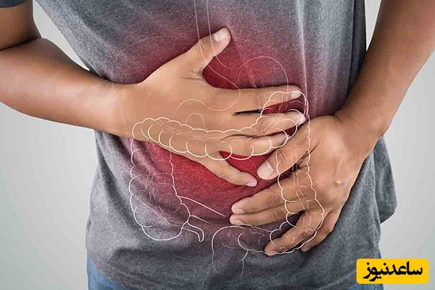 کولیت اولسراتیو چیست؟ آشنایی با داروی بالسالازید و عوارض آن