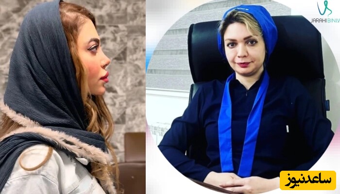 تکنیک‌های نوین در جراحی بینی