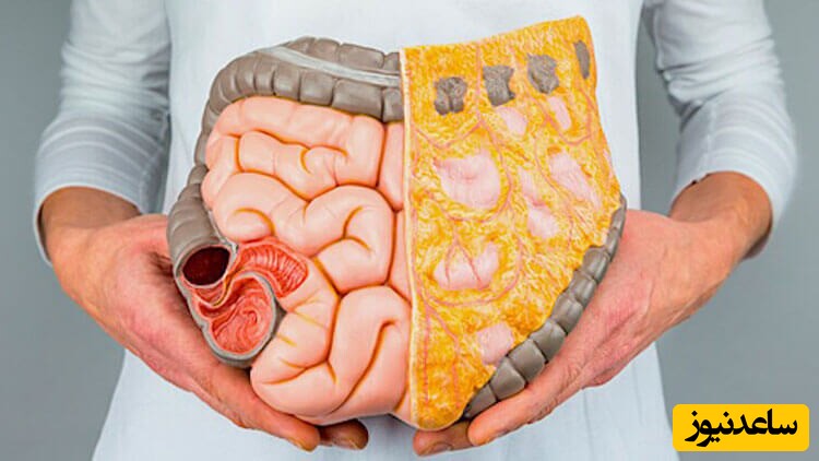 شربت لاکسی ژل چیست؟