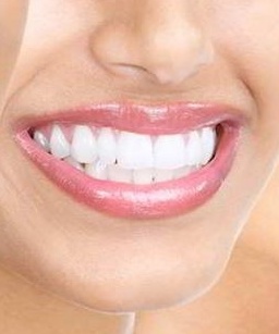 انواع پوسیدگی‌های دندان از نظر عمق