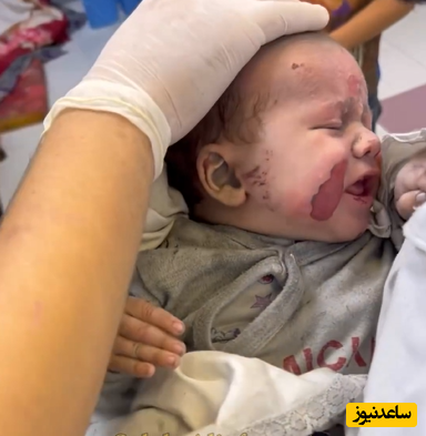 (فیلم) جیغ و داد کودکان مظلوم غزه از شدت درد زخم های عمیق در حین مداوا/ قلب آدم تیکه تیکه میشه