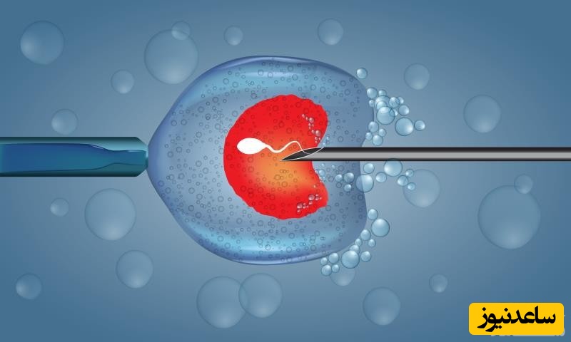 همه چیز درباره میکرواینجکش ICSI
