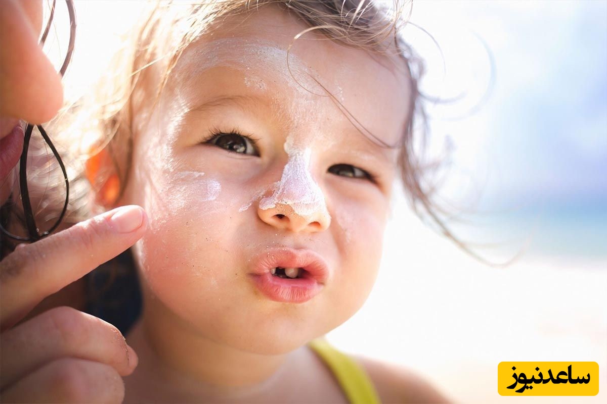 ضد آفتاب کودکان