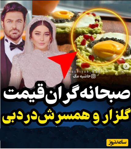 گلزار پز نیست سبک زندگیمه رو به وعده‌های غذائیش کشاند؛ نمایش صبحانه اشرافی که یه لقمه‌اش اندازه یه ماه خورد و خوراک ما هزینه داره!!+عکس