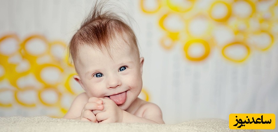 دلایل ابتلای جنین به سندرم داون