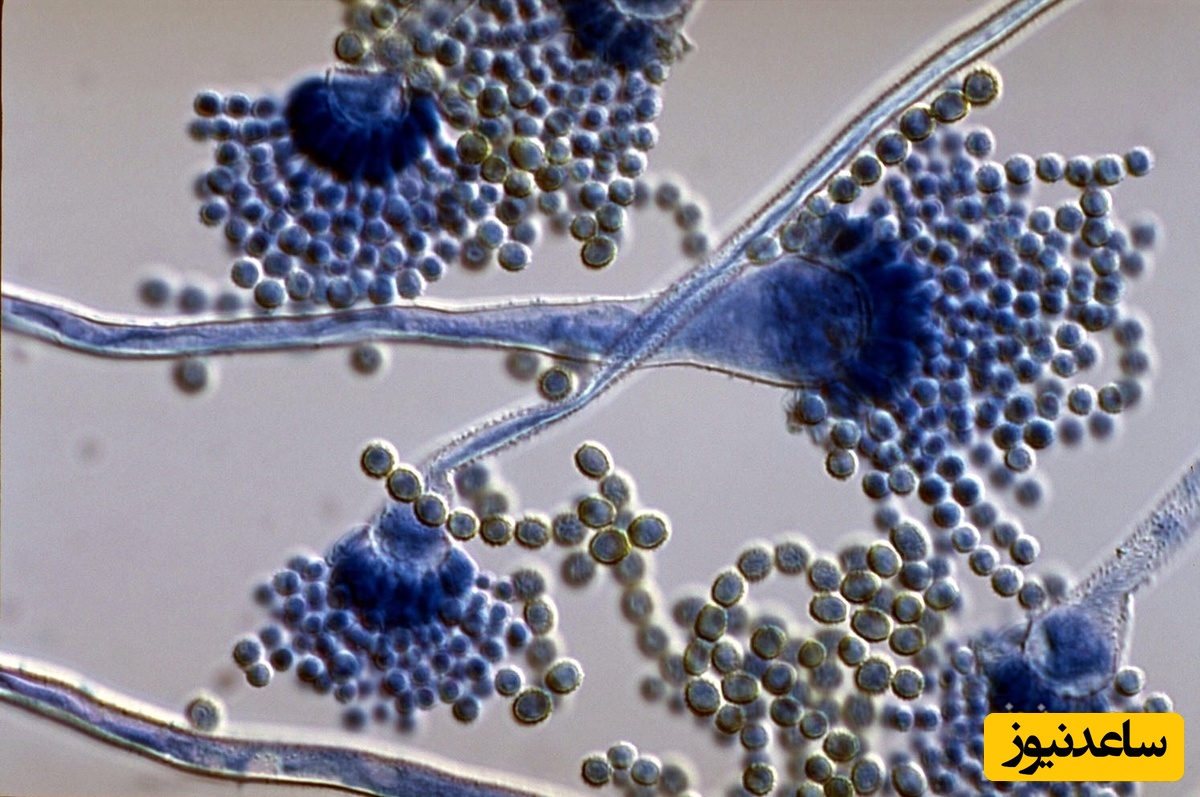 آشنایی با رشته قارچ شناسی پزشکی و بازار کار آن