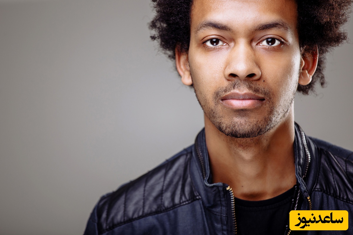 فیلر پوست تیره؛ نکات ایمنی و مراقبت