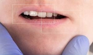 روش های درمان انحراف فک با جراحی