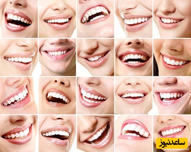 دندان مصنوعی چطور تمیز می شود؟