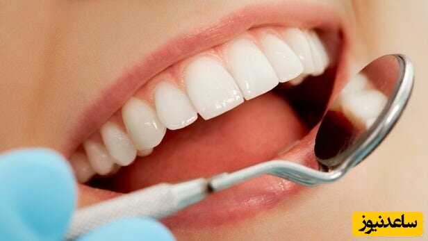 پر کردن دندان با کامپوزیت بهتر است یا آمالگام؟