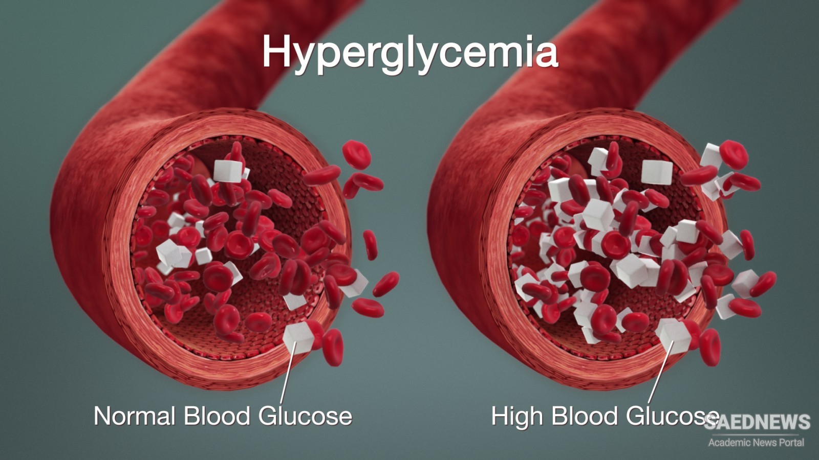 हाइपरग्लेसेमिया (उच्च रक्त शर्करा), लक्षण, कारण और इलाज
