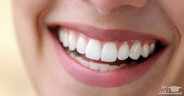 علل لق شدن دندان ها در بزرگسالان چیست؟