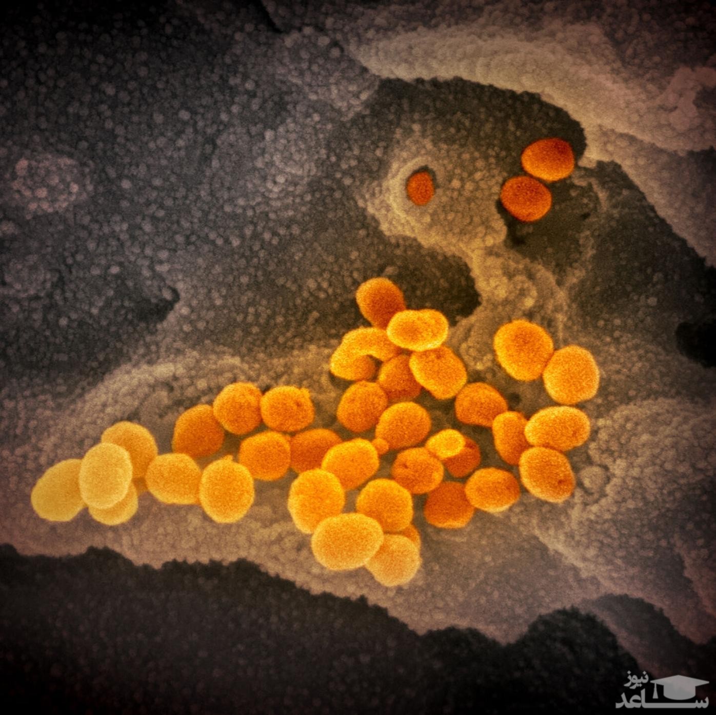 یک داروی ضد ویروس، میزان عفونت کووید-۱۹ را در ریه‌های همسترها کاهش داد