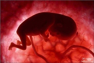 خوراکی های که موجب سقط یا ناقص شدن جنین میشوند