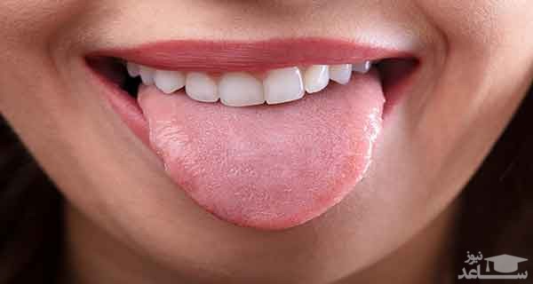 علل و درمان خشکی دهان