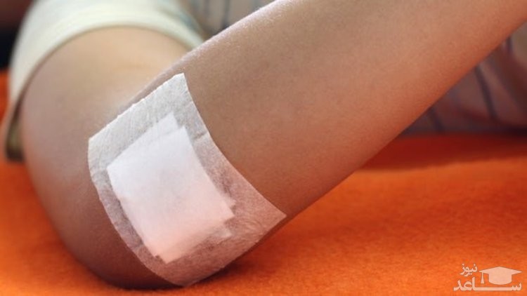 کرونا از راه زخم هم منتقل می‌شود؟