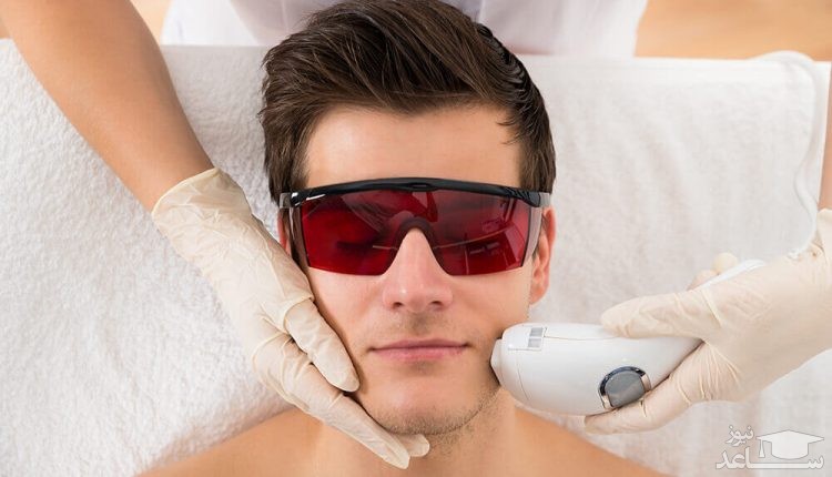 اقدامات مهم قبل از لیزر موهای زائد مردان