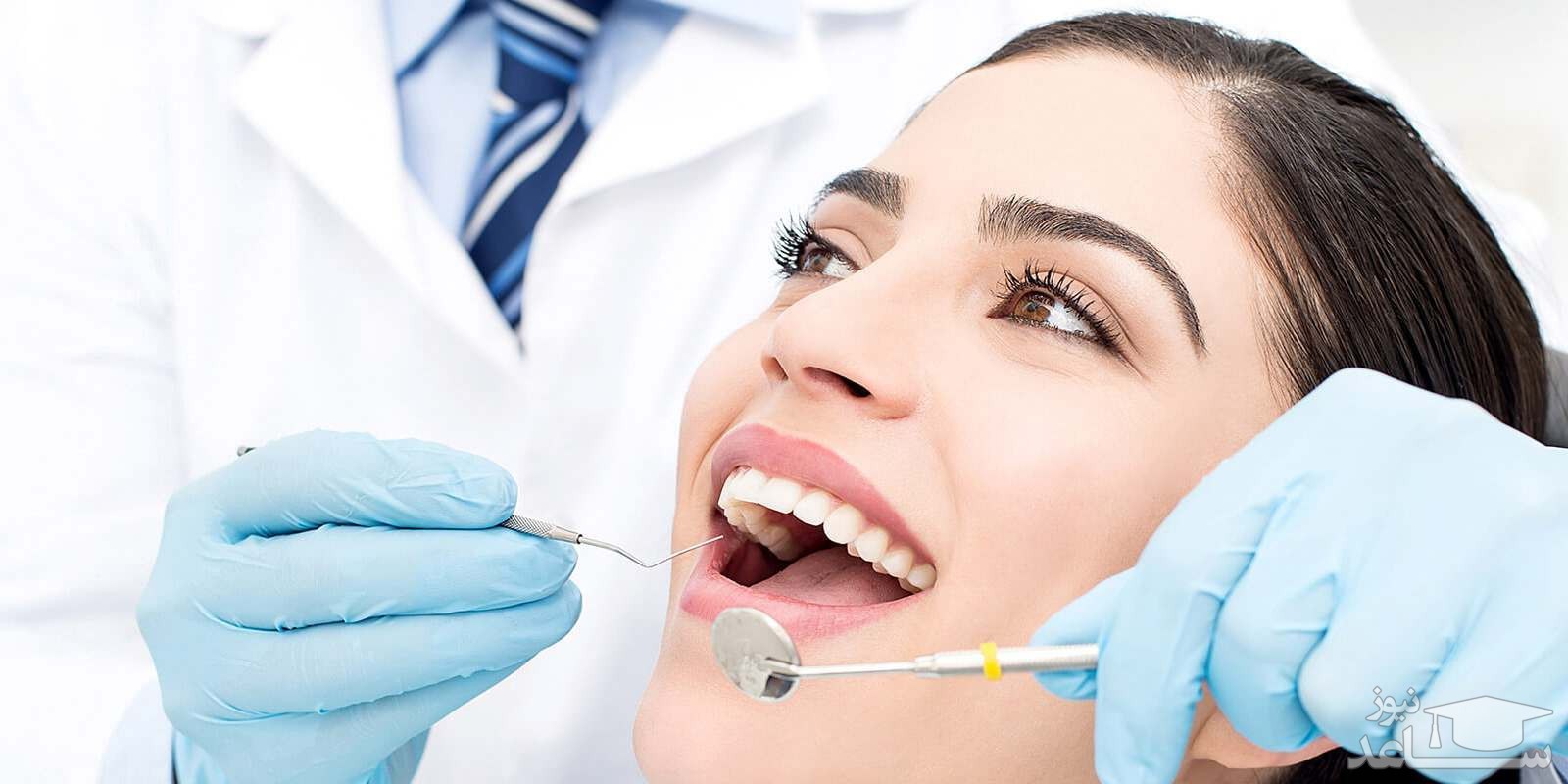 انواع جنس روکش دندان چیست؟