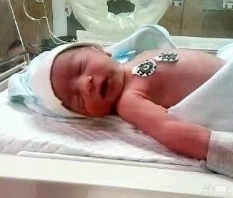 مرگ نوزاد در یکی از بیمارستان های لاکچری تهران!