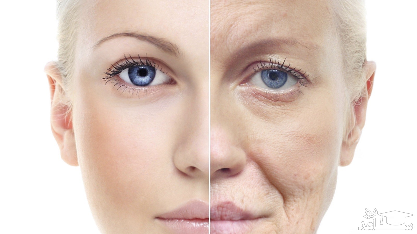 مراقبت های قبل و بعد از لیفت صورت با نخ