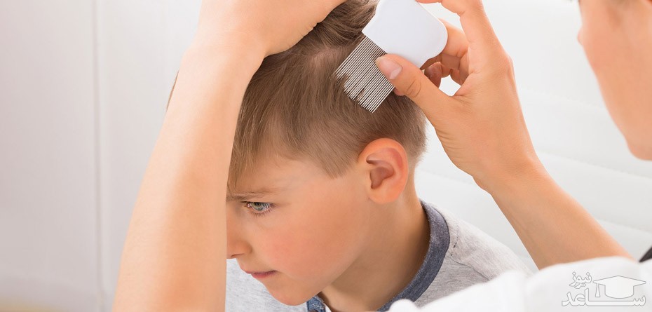 روش از بین بردن شپش موی سر کودکان با اسپند