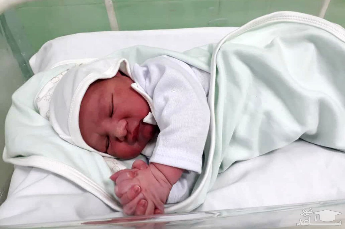 به دنیا آمدن نوزادی عجیب الخلقه در مصر